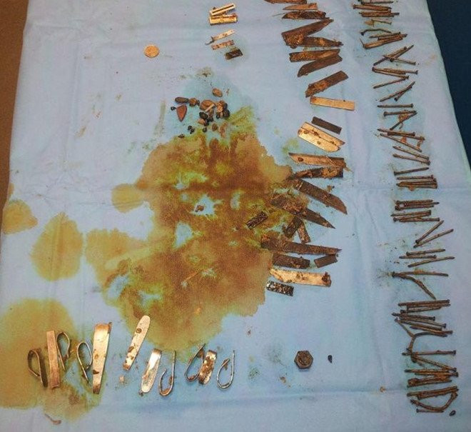 Nguoi dan ong nuot 100 manh kim loai hinh anh 1