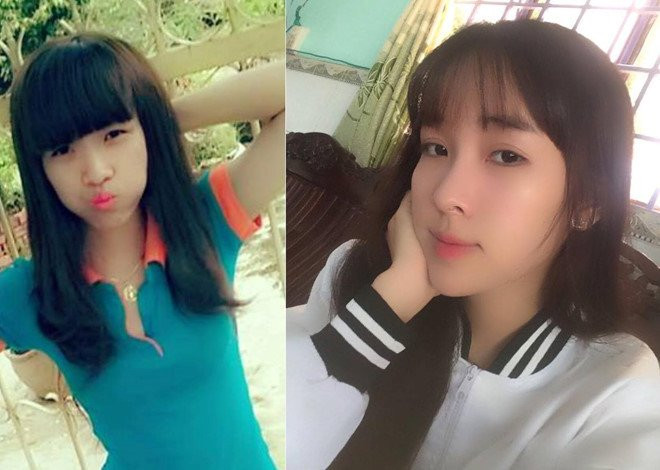 5 co gai Viet lot xac sau khi 'dao keo' hinh anh 7