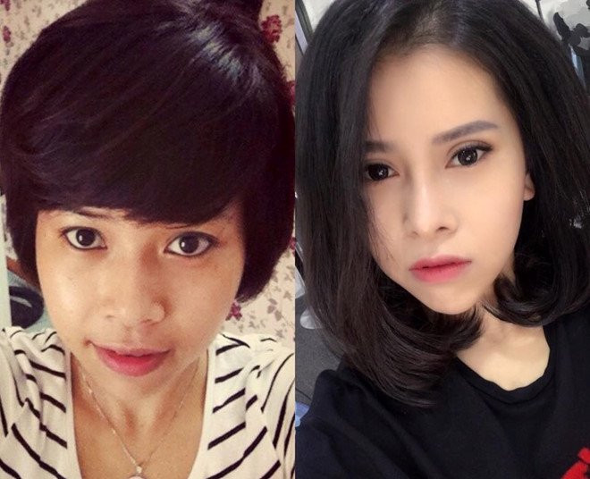 5 co gai Viet lot xac sau khi 'dao keo' hinh anh 3