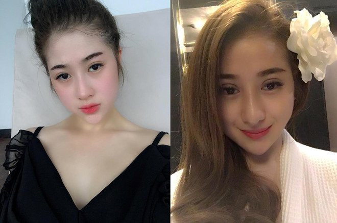 5 co gai Viet lot xac sau khi 'dao keo' hinh anh 9