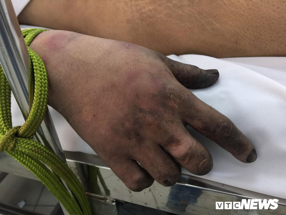 29404632_2054030704810425_2097421529_o 5