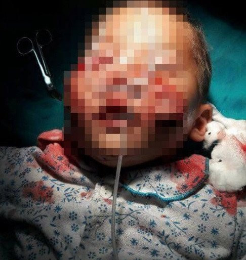 Cho can nat mat be trai 3 tuoi hinh anh 1