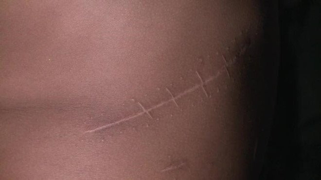 Mua ban than 'nup bong' hien tang nhan dao bi xu ly the nao? hinh anh 1