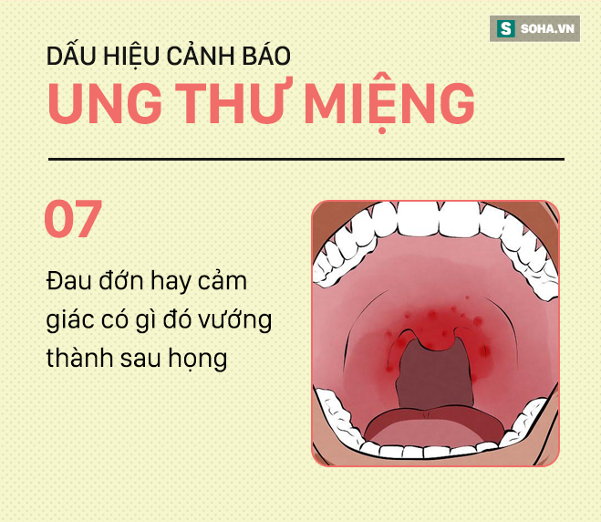 [PHOTO STORY] Đừng nhầm lẫn với bệnh ở miệng, đây là những dấu hiệu cảnh báo ung thư mà bạn nên nhớ - Ảnh 7.