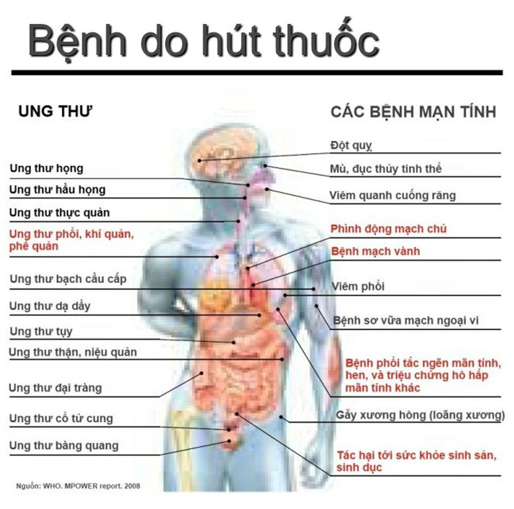 ung thư,bệnh ung thư