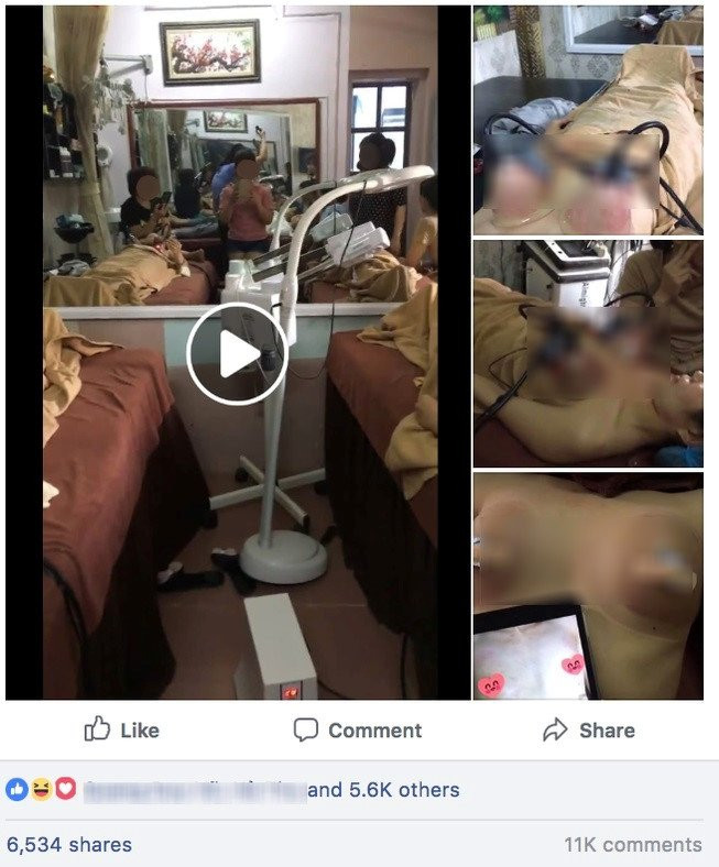 Nang nguc bang may hut chan khong: Tro lua bip cua cac co so lam dep hinh anh 2