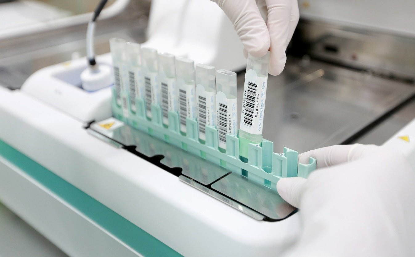 Xét nghiệm tìm máu trong phân giúp phát hiện sớm ung thư đại trực tràng 