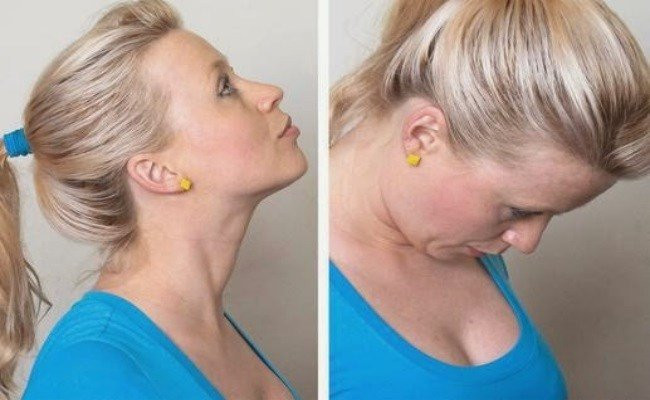 3 cach giam bong mo cam khong can phau thuat hinh anh 2