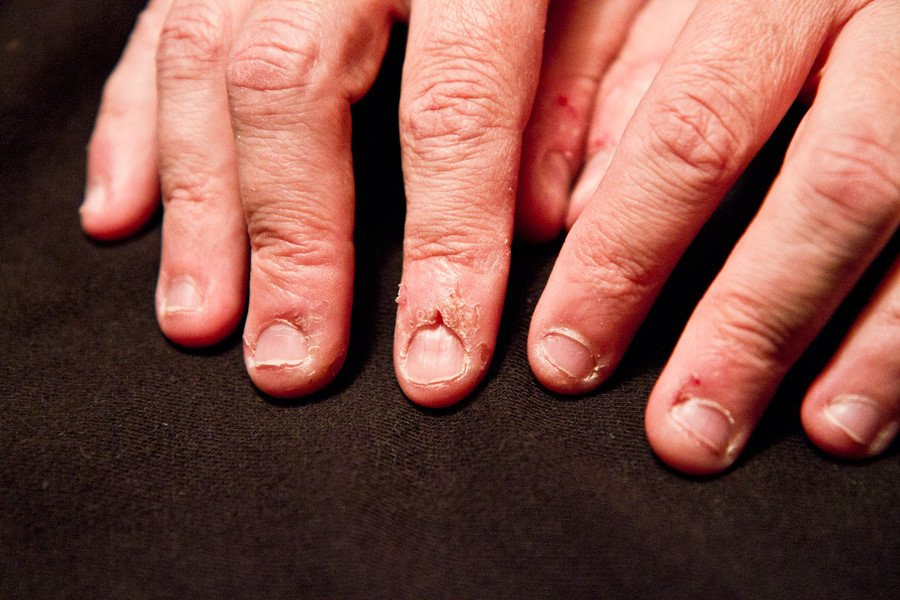 8 hiem hoa bat ngo tu thoi quen can mong tay hinh anh 4