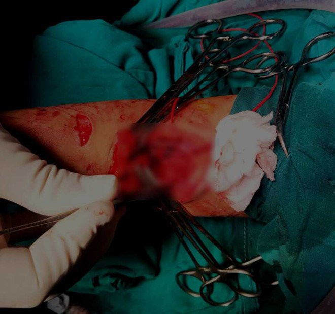 Lan dau cuu song be gai 4 tuo roi tu tang 7 chung cu hinh anh 1