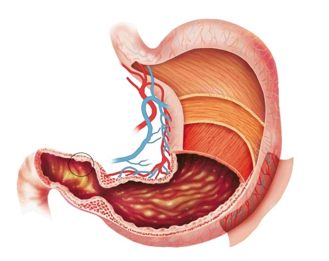 Bất ngờ trước những bộ phận 'mềm yếu' nhất của nam giới