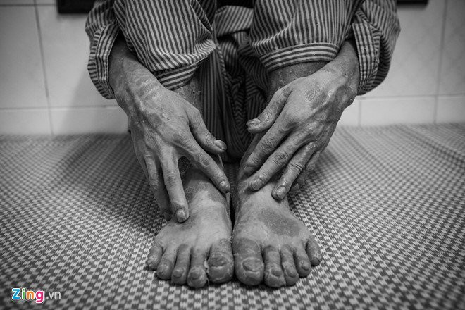 Can benh khien 2 trieu nguoi Viet song trong canh nhieu lan muon tu tu hinh anh 1