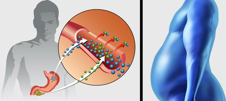7 chung benh nguy hiem gay beo phi hinh anh 3