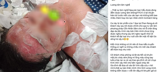 Hình ảnh vị khách kém may mắn