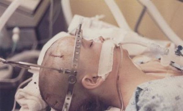 Tiết lộ bất ngờ của cô gái tỉnh dậy sau 20 năm hôn mê sâu