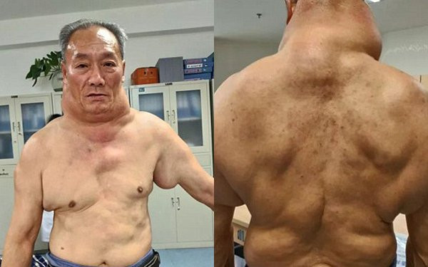 26-nam-uong-ruou-nguoi-dan-ong-thanh-quai-vat-voi-chiec-co-ki-di-1 9