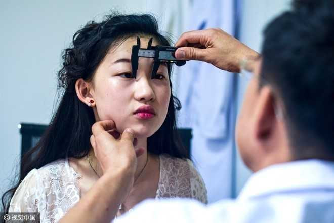 Co gai quyet tam phau thuat tham my giong Luu Diec Phi hinh anh 3