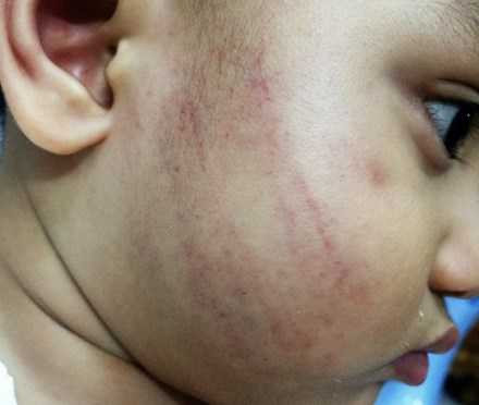 co-giao-mam-non-danh-tre (1)