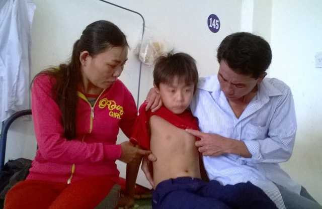 Vợ chồng anh Lượng đưa cháu Hòa đến BV đa khoa tỉnh Phú Yên để chụp CT