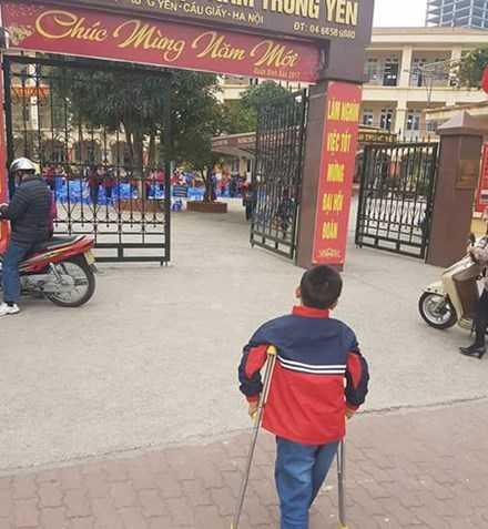 vu-hoc-sinh-gay-chan (2)