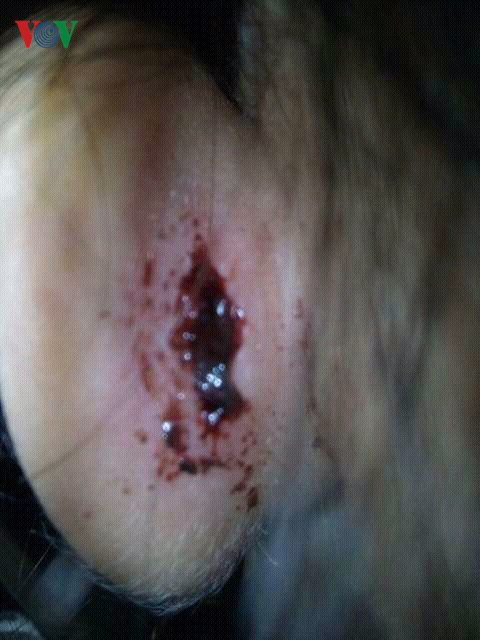 ky luat co giao mam non veo tai khien hoc sinh chay mau tai hinh 1