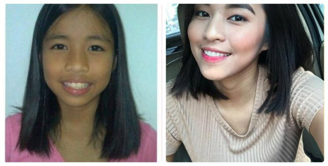 Đen nhẻm hóa hot girl, cô gái đen nhẻm, vịt hóa thiên nga, Aleksis Corbi, hot girl philippines, sinh viên 19 tuổi, hot girl, gái xinh, người đẹp, hành trình làm đẹp, làm đẹp, phụ nữ, thời trang, vtc, 24h, vtc.vn - 4