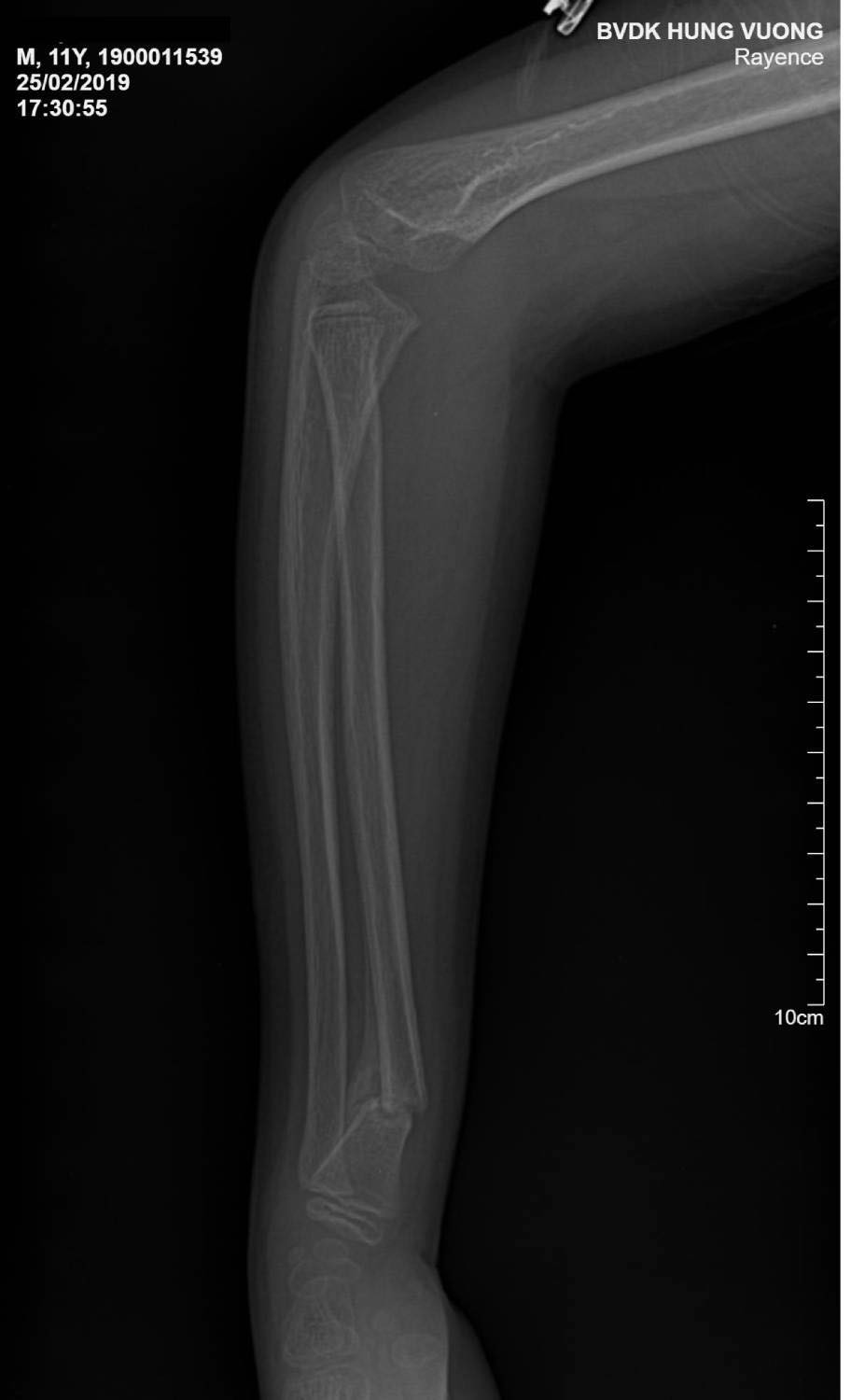 52989700_2163825260331073_3503267740876013568_n