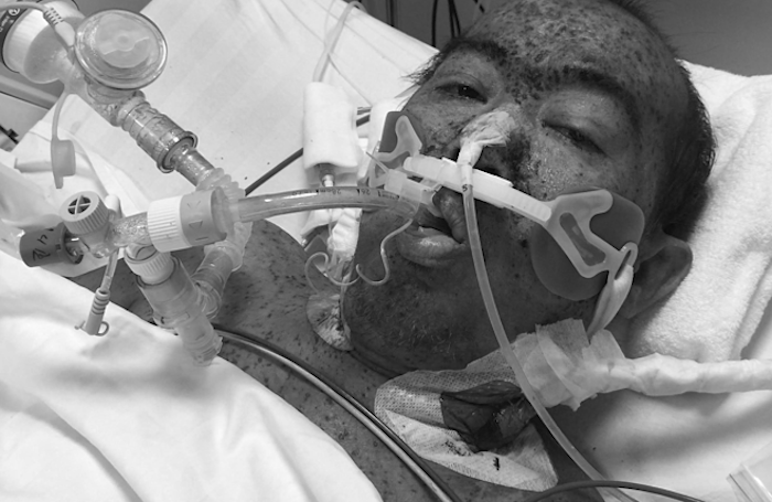 sokun-khi-moi-nhap-vien-cih-co-3906-5152-1558579302