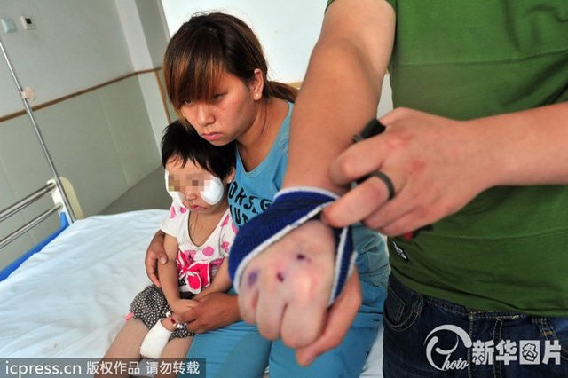 nhung-tai-nan-dam-mau-vi-cho-ngao-tay-tang