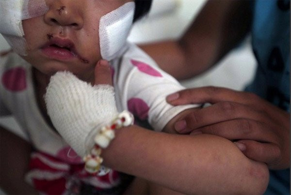 nhung-vu-cho-ngao-tay-tang-giet-nguoi-kinh-hai-hinh-9 3