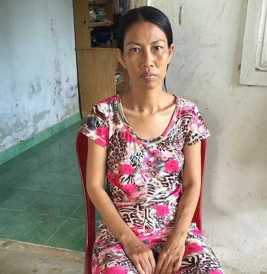 benh-nhan-bi-cat-nham-than-doi-boi-thuong-hon-nua-ti-dong