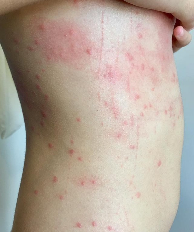 36559800-1280200782110731-7242125600557629440-n-bb-baaad2U5WI