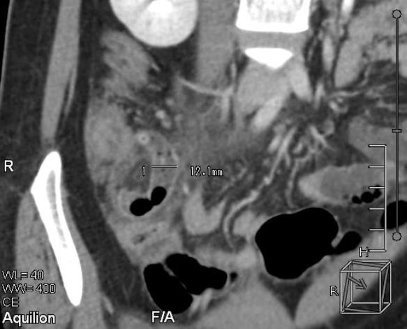 b178c0cd90f771a928e6