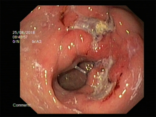 42535647_1150061968494310_4965817926092324864_n