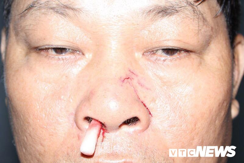 43878188_477988099365945_5783125794221981696_n