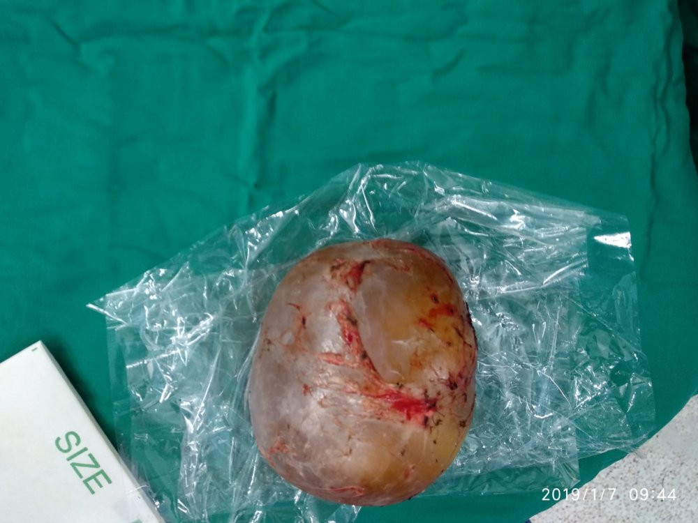 8ac5d5833560d63e8f71