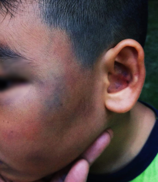 643629064829417658102818288873623821746176n-156067376091871114141-1560673844746343677894