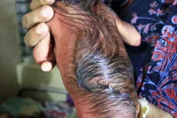 PAY-A-baby-boy-who-was-born-with-a-condition-called-Progeria-in-Bangladesh (3)