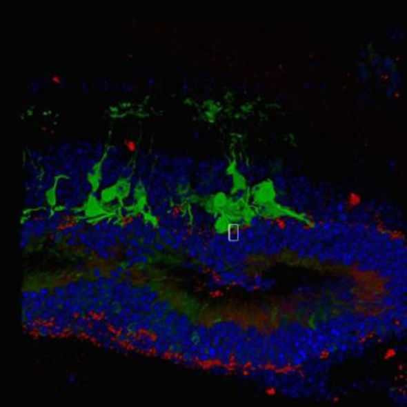 Mandai-et-al-Stem-Cell-Reports-2017-785739
