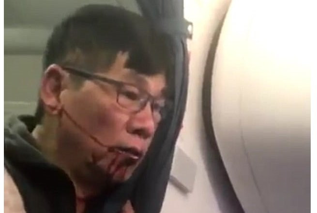 Hinh anh Bac si goc Viet bi loi keo tho bao khoi may bay se kien hang United Airlines?