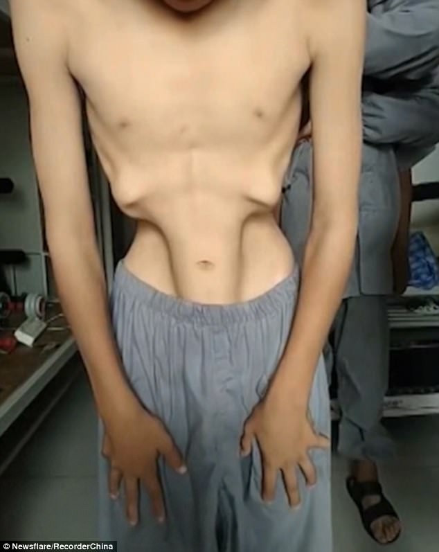 de-tu-thieu-lam-mua-bung-1