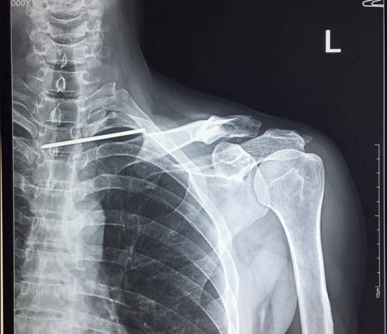 39454642_463477400797315_1759607724183650304_n