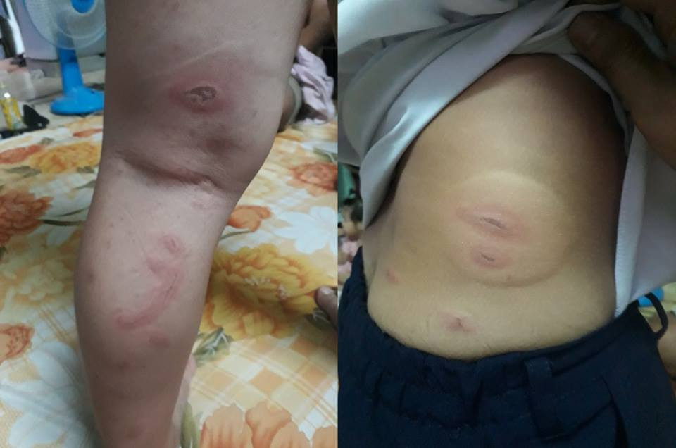 40355704_274506999831312_2960104714672275456_n