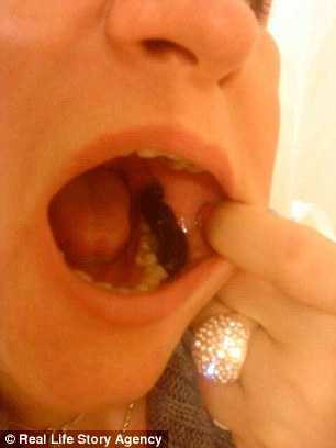 giam-can-nho-lieu-phap-dia1