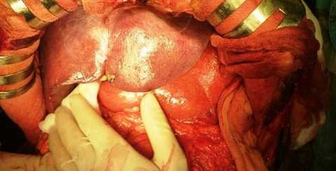 gan-e64ae-1434417226815-117-0-443-639-crop-1434417267967