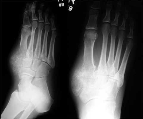 5-loai-ung-thu-ma-ban-chua-tung-nghe-thay