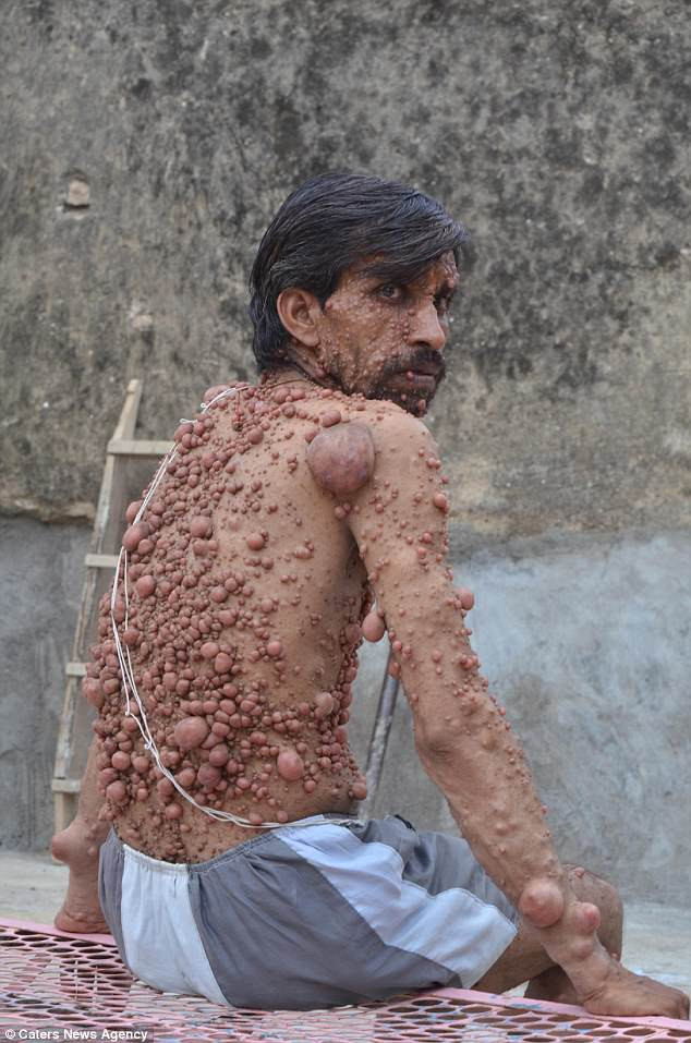 440A759100000578-4865534-image-a-16_1504878871930