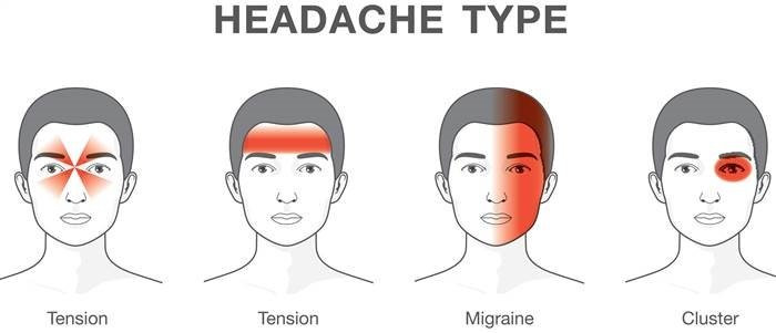 headache-types-today-161109-inline-02_54029d2d360cad513cf6c9f5ba6f484d.today-inline-large 3