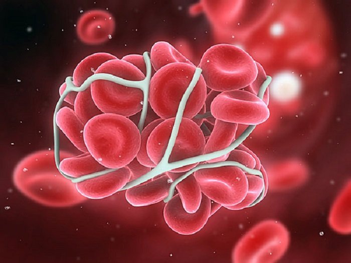 xbloodcancer33-22-1511328268.jpg.pagespeed.ic._OOFQSZ_uQ
