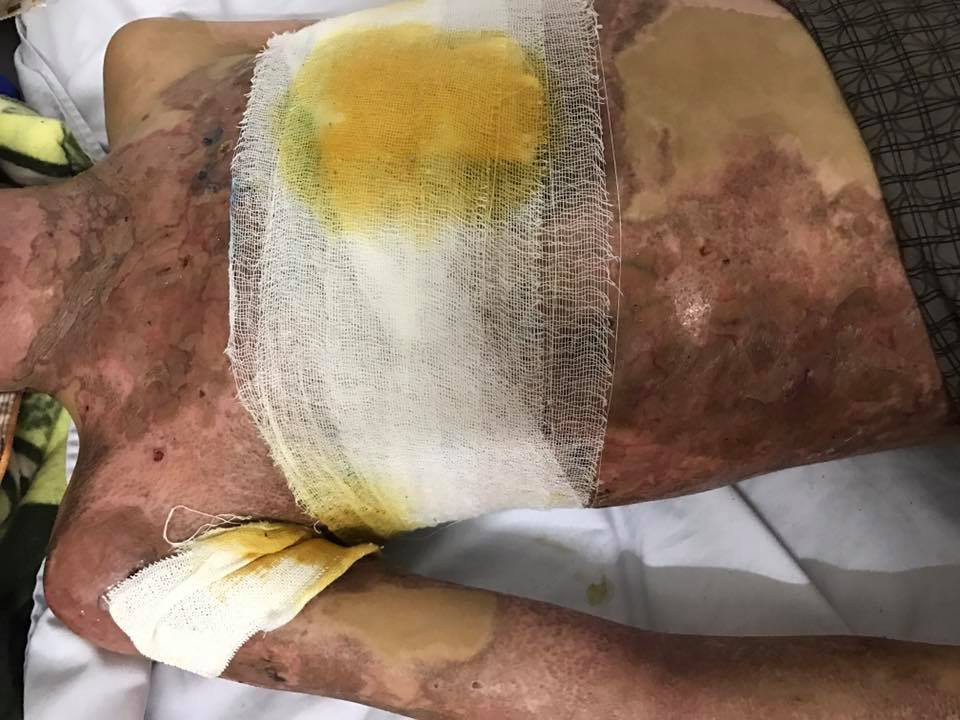 18881857_1925892304313904_5690298993305282309_n 3